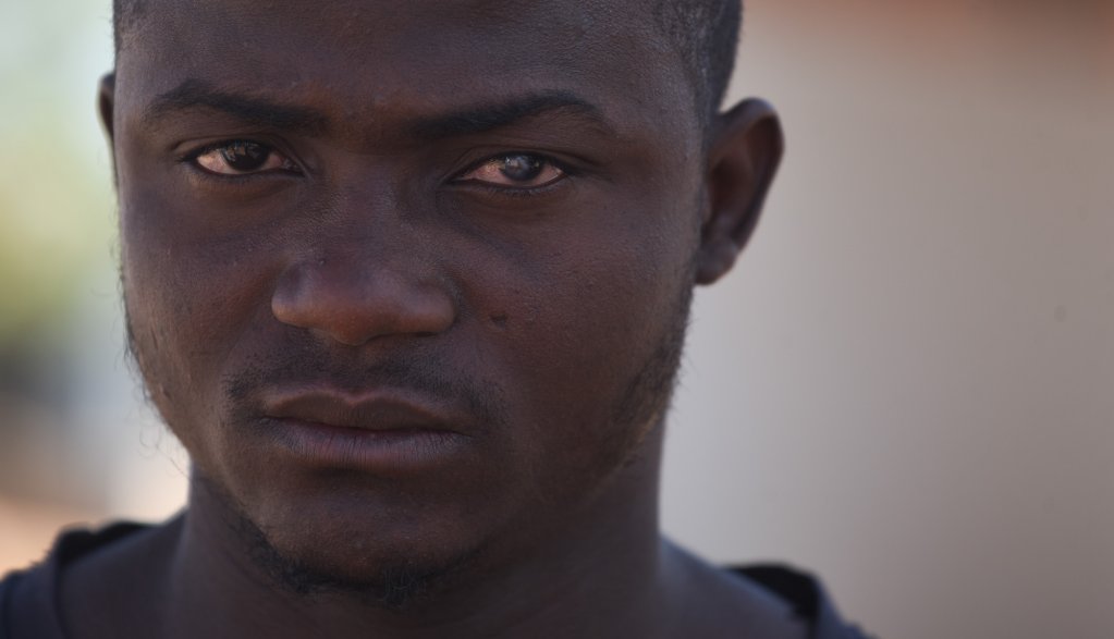 Husseimi Hamissou a été frappé au visage par un garde algérien lors de son expulsion, son oeil a été touché. La blessure s'est aggravée avec le vent du désert et le sable. Il affirme désormais ne quasiment plus voir de l'oeil gauche. Crédit : Mehdi Chebil