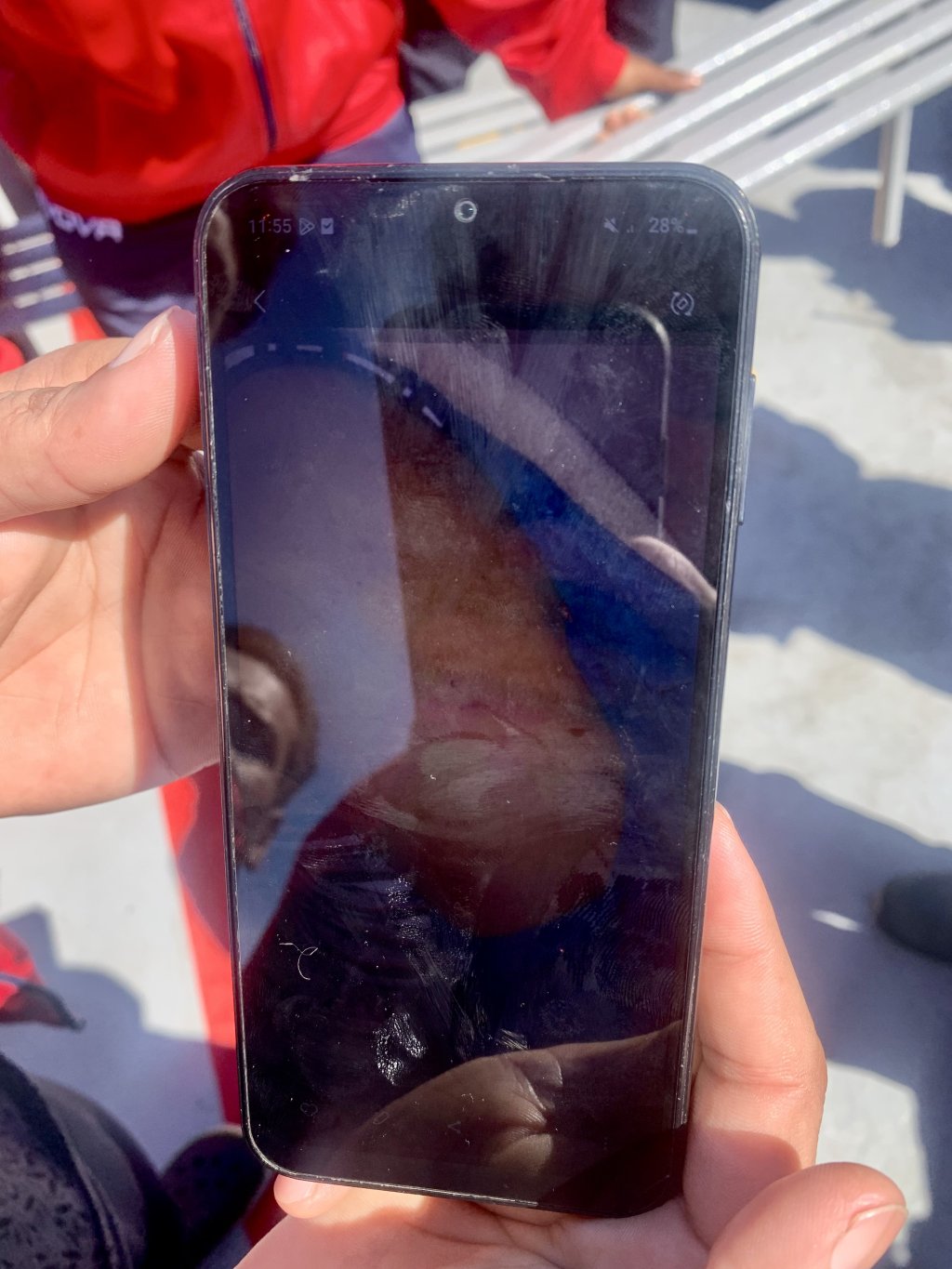 Migrants showed pictures of bruises they said were from the Libyan prison guard to InfoMigrants. | Photo: Clare Roth/InfoMigrants