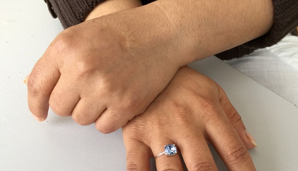 File photo:The hands of a woman showing scars of domestic violence, Bamberg Ankerzentrum, December 10, 2019 | Photo: InfoMigrants/M. MacGregor