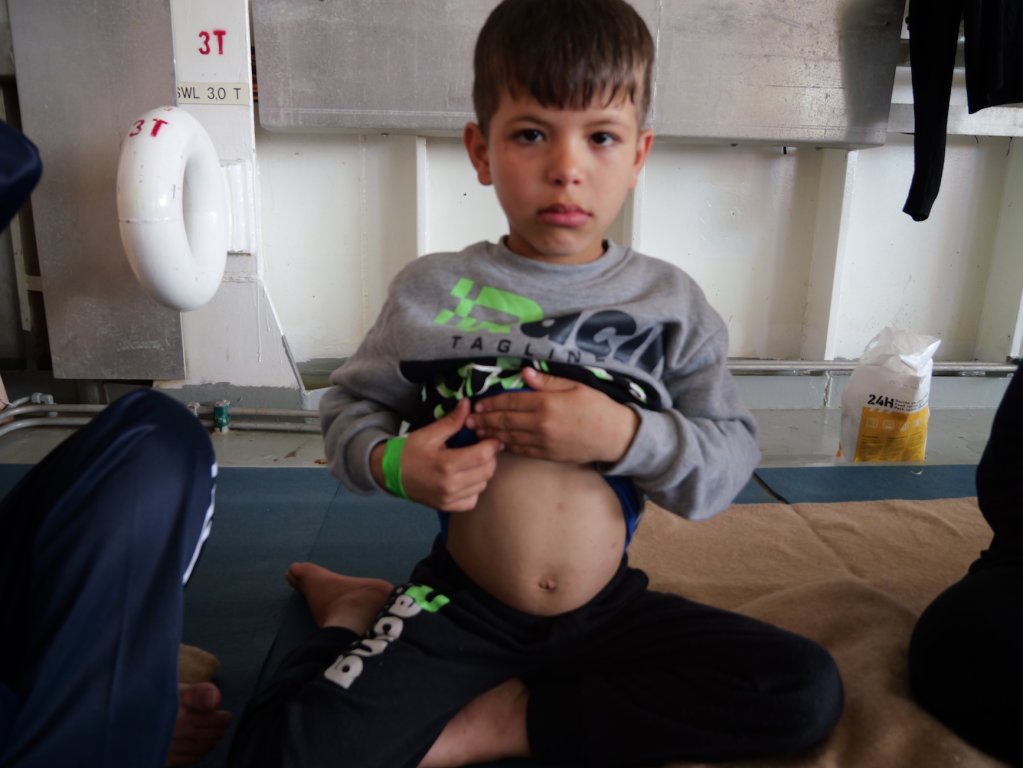 Nour is worried about her young son's health. Her child fell ill while in detention in Libya and suffered from scabies due to overcrowded and unsanitary living conditions. Nour's son shows the marks and bites on his stomach | Geo Barents, Central Mediterranean Sea, February, 2024 | Photo: Sou-Jie van Brunnersum
