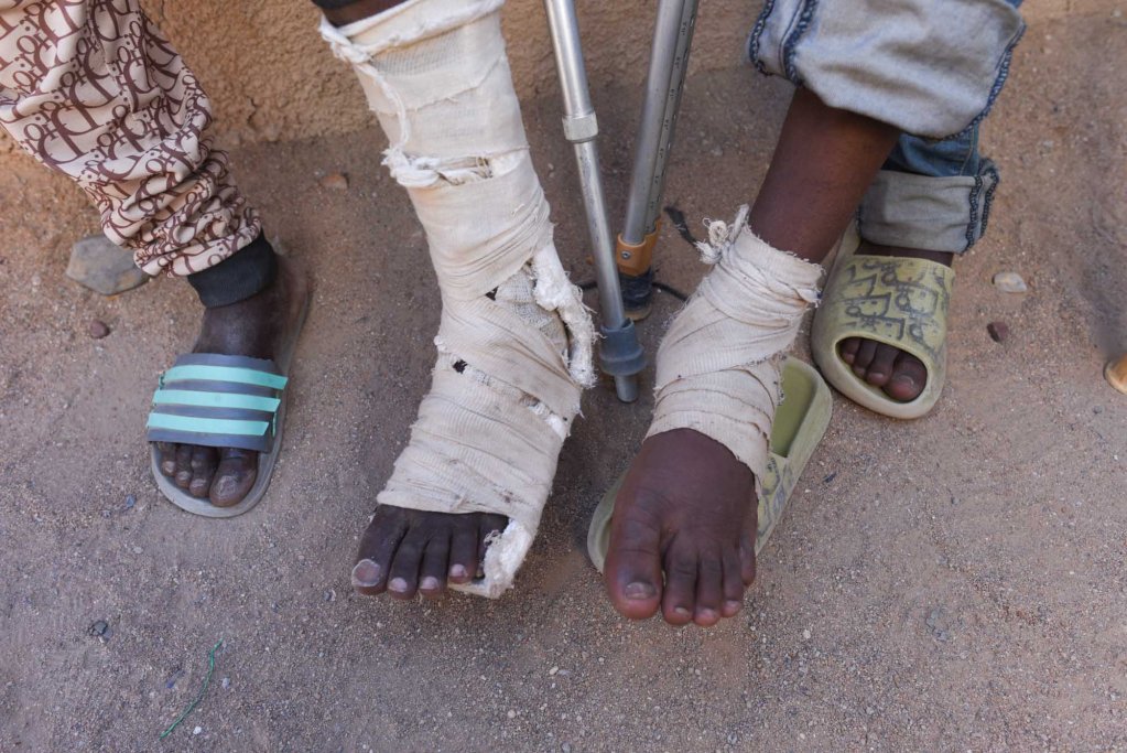 Les deux jeunes Guinéens ont été blessés au pied lors de leur arrestation à Oran. Crédit : Mehdi Chebil