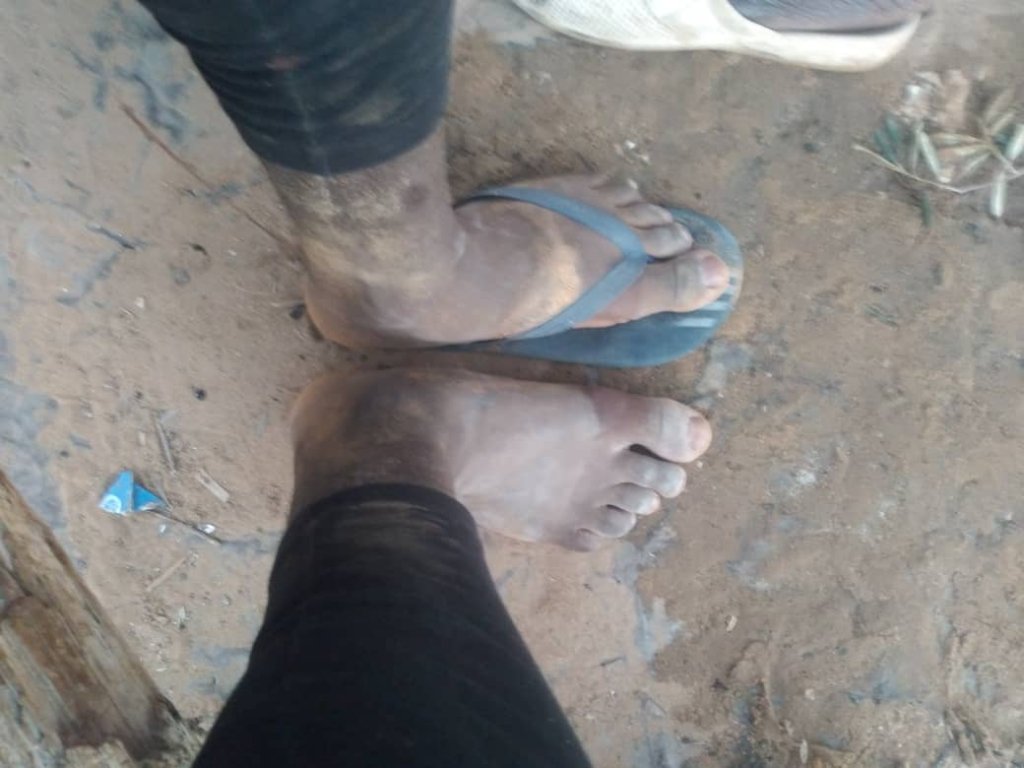 Many people in the migrant camp do not have enough clothing for the cold weather in North Africa this January | Photo: Private