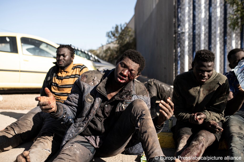 An injured migrant after crossing the fence of Melilla (Spain), on March 2, 2022 | Photo: Europa Press/abaca/picture alliance