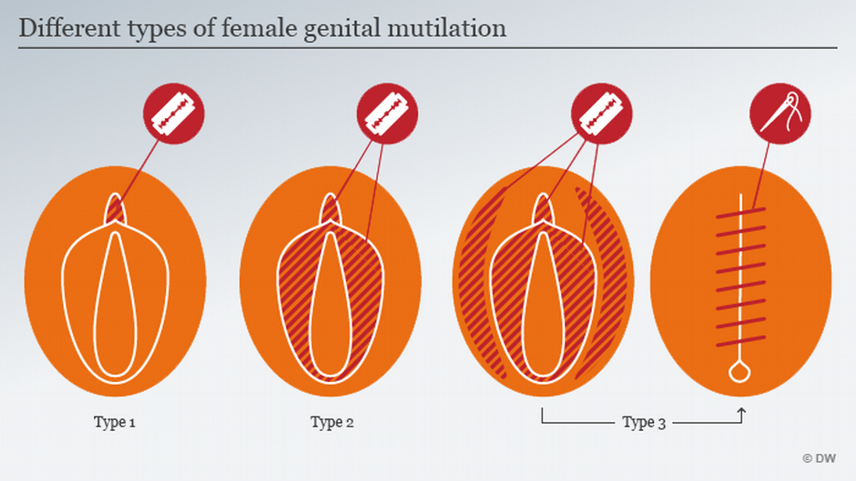 Types of FGM