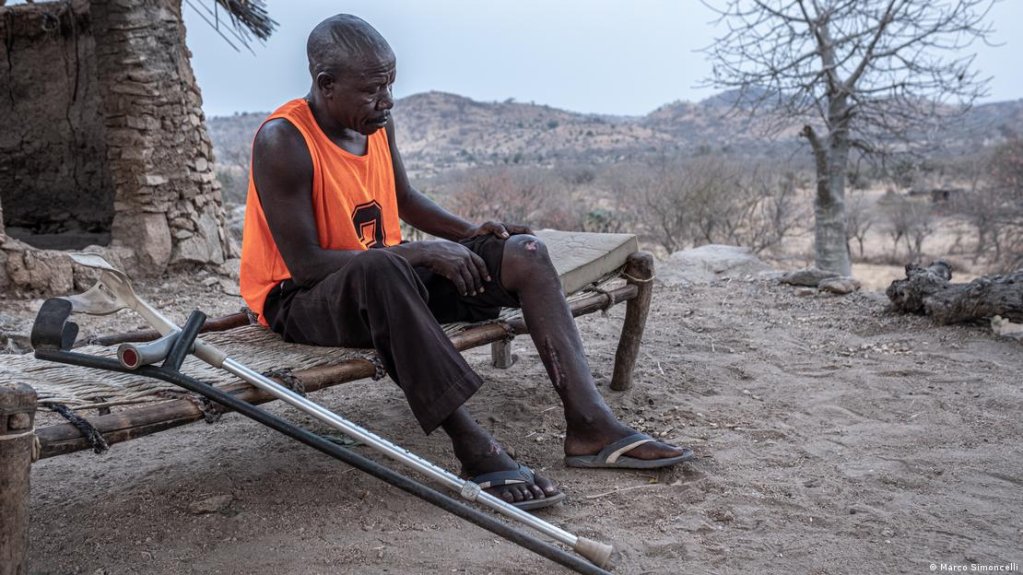 Hassan Koko shows the scars on his legs | Photo: Marco Simoncelli