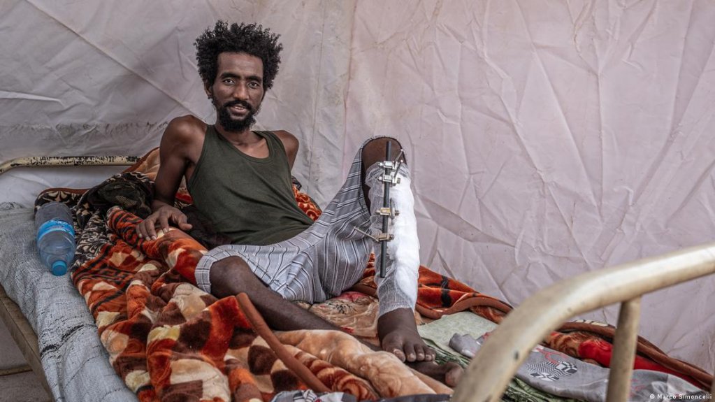 Hassan Hamid, an injured RSF fighter, pictured at the Mother of Mercy Hospital | Photo: Marco Simoncelli