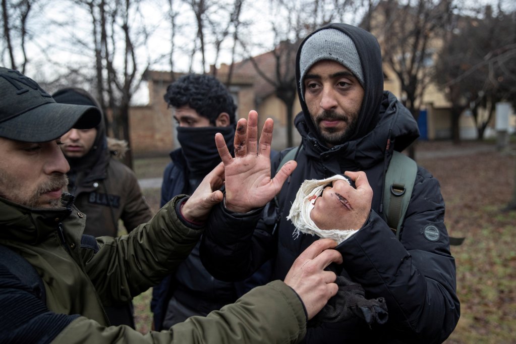 Cet homme affirme avoir été blessé par la police hongroise alors qu'il tentait de traverser la frontière depuis la Serbie vers la Hongrie, le 28 janvier 2020. Crédit : Reuters