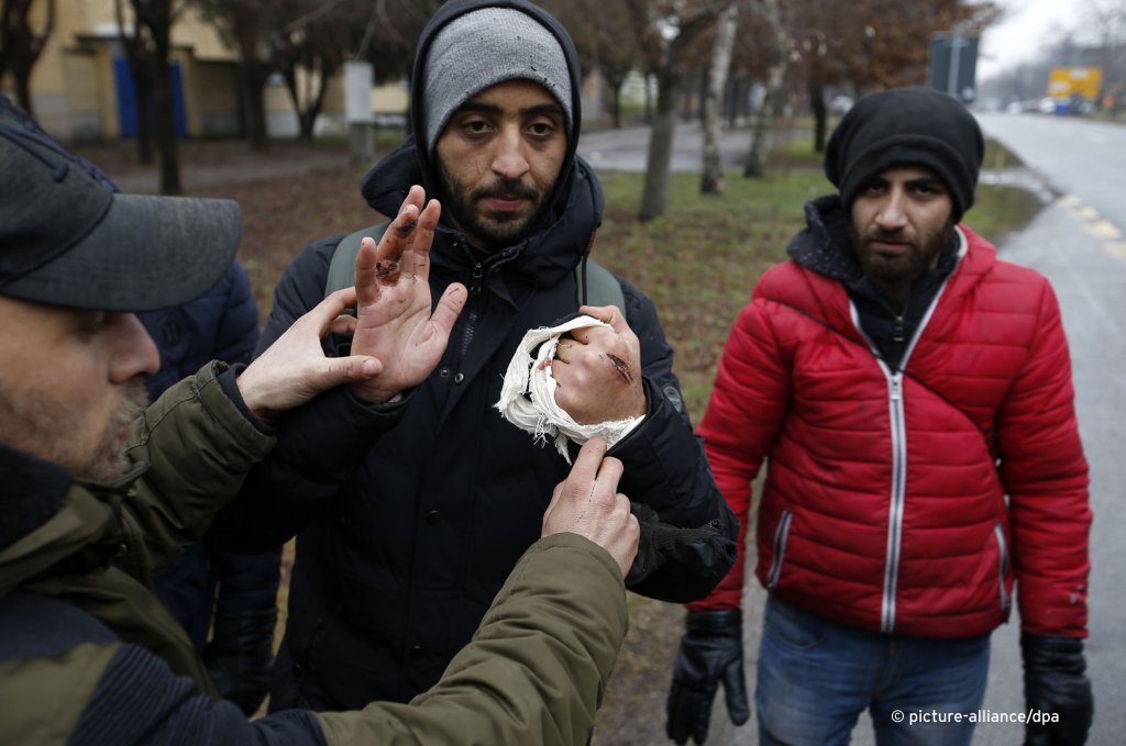 A migrant shows cuts on the hands in village of Horgos, Serbia, Tuesday, Jan. 28, 2020. A security guard fired three warning shots when several dozen migrants tried to enter Hungary Tuesday through a border crossing with Serbia, Hungarian police said | Photo: AP Photo/Darko Vojinovic